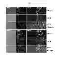 Fig. 07 - Peptide bone forming peptide 4 for promoting osteogenesis or vascularization and use thereof