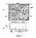 Fig. 04 - Methods of Use of Inhibitors of Phosphodiesterases and Modulators of Nitric Oxide, Reactive Oxygen Species, and Metalloproteinases in the Treatment of Peyronie's Disease, Arteriosclerosis and Other Fibrotic Diseases