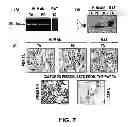 Fig. 08 - Methods of Use of Inhibitors of Phosphodiesterases and Modulators of Nitric Oxide, Reactive Oxygen Species, and Metalloproteinases in the Treatment of Peyronie's Disease, Arteriosclerosis and Other Fibrotic Diseases