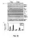 Fig. 11 - Methods of Use of Inhibitors of Phosphodiesterases and Modulators of Nitric Oxide, Reactive Oxygen Species, and Metalloproteinases in the Treatment of Peyronie's Disease, Arteriosclerosis and Other Fibrotic Diseases