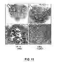 Fig. 12 - Methods of Use of Inhibitors of Phosphodiesterases and Modulators of Nitric Oxide, Reactive Oxygen Species, and Metalloproteinases in the Treatment of Peyronie's Disease, Arteriosclerosis and Other Fibrotic Diseases