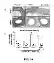 Fig. 16 - Methods of Use of Inhibitors of Phosphodiesterases and Modulators of Nitric Oxide, Reactive Oxygen Species, and Metalloproteinases in the Treatment of Peyronie's Disease, Arteriosclerosis and Other Fibrotic Diseases