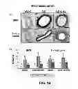 Fig. 17 - Methods of Use of Inhibitors of Phosphodiesterases and Modulators of Nitric Oxide, Reactive Oxygen Species, and Metalloproteinases in the Treatment of Peyronie's Disease, Arteriosclerosis and Other Fibrotic Diseases