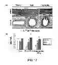 Fig. 18 - Methods of Use of Inhibitors of Phosphodiesterases and Modulators of Nitric Oxide, Reactive Oxygen Species, and Metalloproteinases in the Treatment of Peyronie's Disease, Arteriosclerosis and Other Fibrotic Diseases
