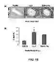 Fig. 19 - Methods of Use of Inhibitors of Phosphodiesterases and Modulators of Nitric Oxide, Reactive Oxygen Species, and Metalloproteinases in the Treatment of Peyronie's Disease, Arteriosclerosis and Other Fibrotic Diseases