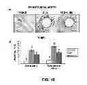 Fig. 20 - Methods of Use of Inhibitors of Phosphodiesterases and Modulators of Nitric Oxide, Reactive Oxygen Species, and Metalloproteinases in the Treatment of Peyronie's Disease, Arteriosclerosis and Other Fibrotic Diseases