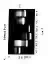 Fig. 09 - Methods for determining and inhibiting rheumatoid arthritis associated with the BRAF oncogene in a subject