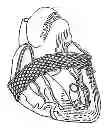 Fig. 01 - Method and apparatus for external stabilization of the heart