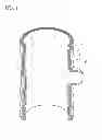 Fig. 02 - Diverticulum inverting device