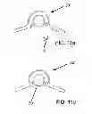 Fig. 06 - POSITIONAL STABILIZATION AND SECUREMENT COUPLING ATTACHMENT FOR USE IN LAPAROSCOPIC SURGERY AND METHOD OF USE