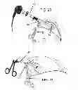 Fig. 11 - POSITIONAL STABILIZATION AND SECUREMENT COUPLING ATTACHMENT FOR USE IN LAPAROSCOPIC SURGERY AND METHOD OF USE