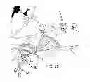 Fig. 12 - POSITIONAL STABILIZATION AND SECUREMENT COUPLING ATTACHMENT FOR USE IN LAPAROSCOPIC SURGERY AND METHOD OF USE