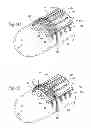 Fig. 07 - Systems and methods for treating dysfunctions in the intestines and rectum that adapt to the anatomic form and structure of different individuals