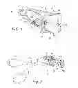Fig. 02 - Treatment method including tissue occlusion device