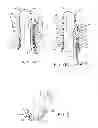 Fig. 04 - Treatment method including tissue occlusion device