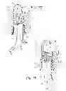 Fig. 06 - Treatment method including tissue occlusion device