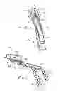 Fig. 09 - Treatment method including tissue occlusion device