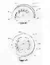 Fig. 03 - Access device for accessing tissue
