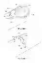 Fig. 06 - Access device for accessing tissue