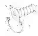 Fig. 02 - In-dwelling port for access into a body