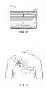 Fig. 08 - PHYSIOLOGICAL SENSOR HAVING BIODEGRADABLE OPTICS