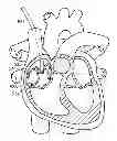 Fig. 01 - Catheter systems and related methods for mapping, minimizing, and treating cardiac fibrillation