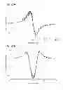 Fig. 23 - Catheter systems and related methods for mapping, minimizing, and treating cardiac fibrillation