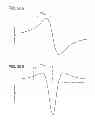 Fig. 24 - Catheter systems and related methods for mapping, minimizing, and treating cardiac fibrillation