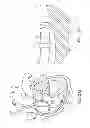 Fig. 29 - Catheter systems and related methods for mapping, minimizing, and treating cardiac fibrillation
