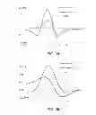 Fig. 31 - Catheter systems and related methods for mapping, minimizing, and treating cardiac fibrillation