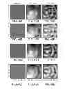 Fig. 41 - Catheter systems and related methods for mapping, minimizing, and treating cardiac fibrillation