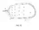 Fig. 65 - Catheter systems and related methods for mapping, minimizing, and treating cardiac fibrillation