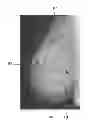 Fig. 01 - Apparatus and method for estimating malignant tumor