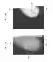 Fig. 05 - Apparatus and method for estimating malignant tumor