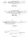 Fig. 11 - INTRALUMINAL IMAGING SYSTEM