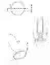 Fig. 15 - INTRALUMINAL IMAGING SYSTEM