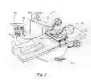 Fig. 02 - Devices, systems and methods  for treating disorders of the ear, nose and throat