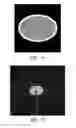 Fig. 13 - Proton scattering analysis system