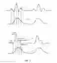 Fig. 08 - Cardiac analysis based on vessel characteristics