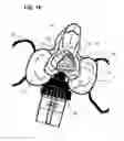Fig. 17 - Universal medical gas delivery system