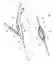 Fig. 04 - Devices, systems and methods for treating tissue regions of the body