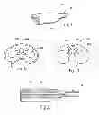Fig. 12 - Devices, systems and methods for treating tissue regions of the body
