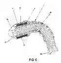 Fig. 06 - METHOD AND APPARATUS FOR SUTURELESSLY CONNECTING A CONDUIT TO A HOLLOW ORGAN