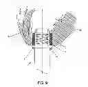 Fig. 09 - METHOD AND APPARATUS FOR SUTURELESSLY CONNECTING A CONDUIT TO A HOLLOW ORGAN