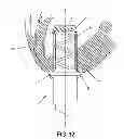 Fig. 12 - METHOD AND APPARATUS FOR SUTURELESSLY CONNECTING A CONDUIT TO A HOLLOW ORGAN
