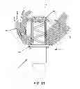 Fig. 13 - METHOD AND APPARATUS FOR SUTURELESSLY CONNECTING A CONDUIT TO A HOLLOW ORGAN