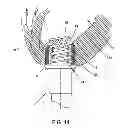 Fig. 14 - METHOD AND APPARATUS FOR SUTURELESSLY CONNECTING A CONDUIT TO A HOLLOW ORGAN