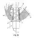 Fig. 16 - METHOD AND APPARATUS FOR SUTURELESSLY CONNECTING A CONDUIT TO A HOLLOW ORGAN