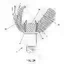 Fig. 24 - METHOD AND APPARATUS FOR SUTURELESSLY CONNECTING A CONDUIT TO A HOLLOW ORGAN