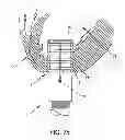 Fig. 25 - METHOD AND APPARATUS FOR SUTURELESSLY CONNECTING A CONDUIT TO A HOLLOW ORGAN